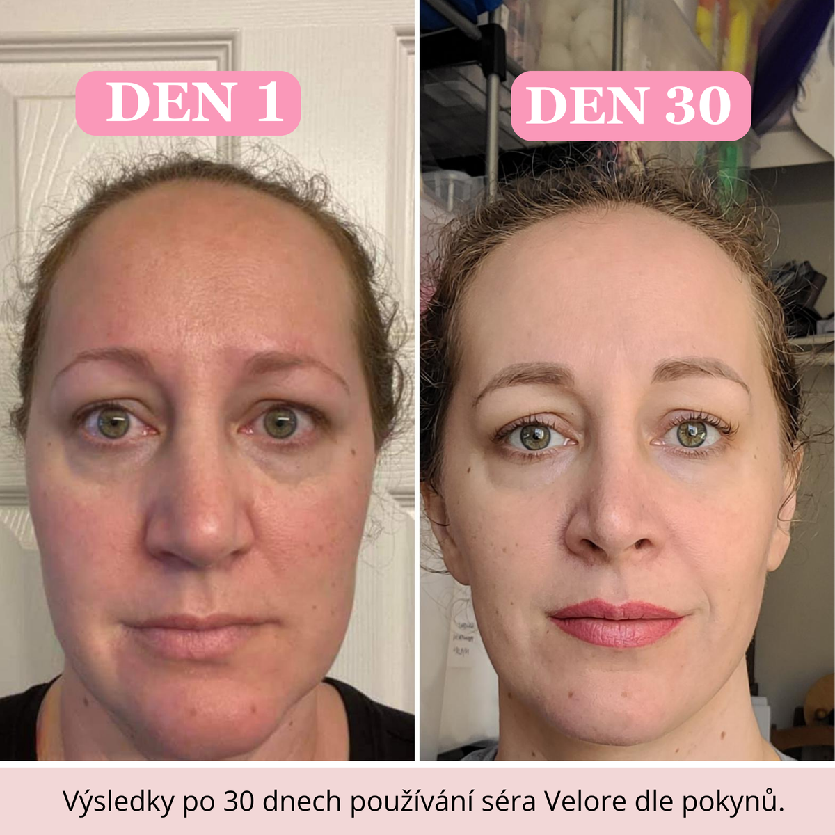 Pleťové sérum VELORE s kyselinou hyaluronovou, vitamínem C a niacinamidem 30 ml