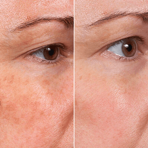 Velore Hyaluronic Peptide Serum