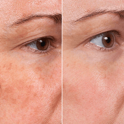 Velore Hyaluronic Peptide Serum